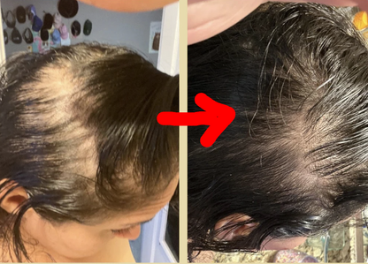 Ulei de crestere a parului 100% natural